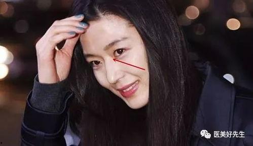 隆过鼻子的女明星